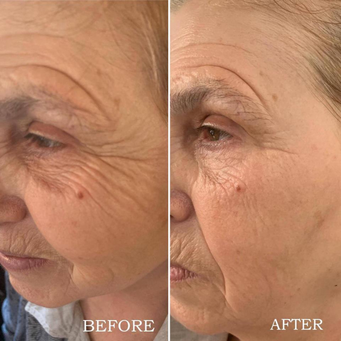 Tratament Anti-Age Soin Multi-Vita Aromalliance BIO [7]