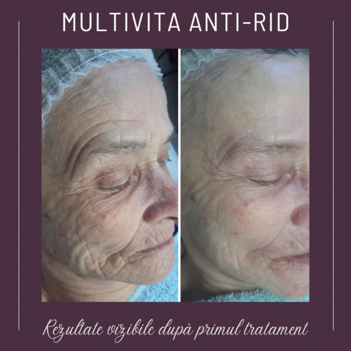 Tratament Anti-Age Soin Multi-Vita Aromalliance BIO [9]
