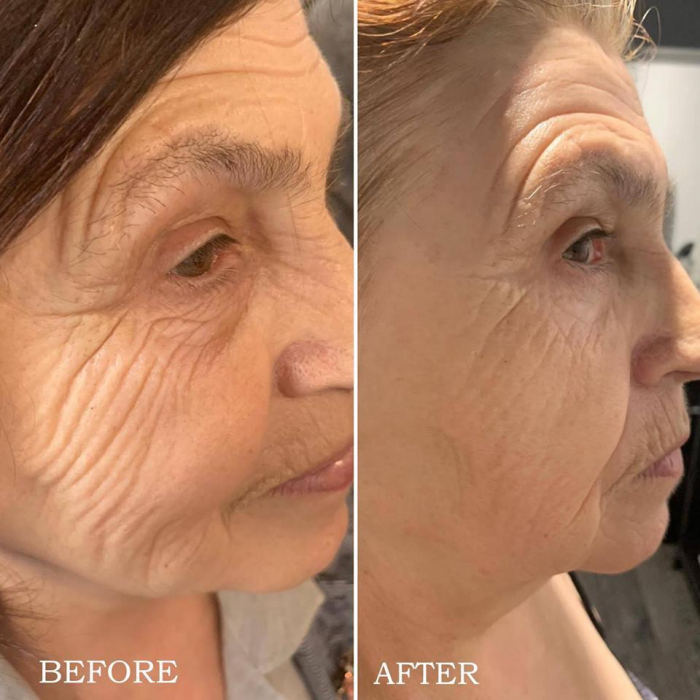 Tratament Anti-Age Soin Multi-Vita Aromalliance BIO [8]