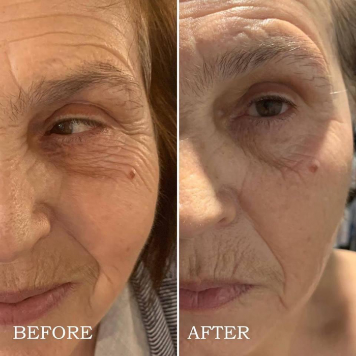 Tratament Anti-Age Soin Multi-Vita Aromalliance BIO [6]