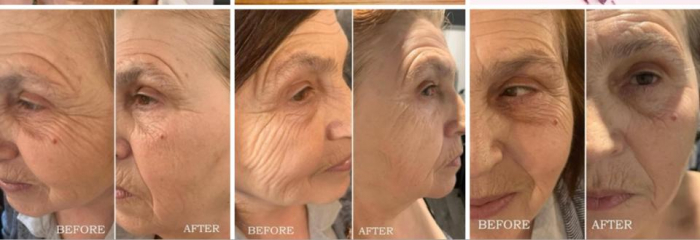 Tratament Anti-Age Soin Multi-Vita Aromalliance BIO [5]