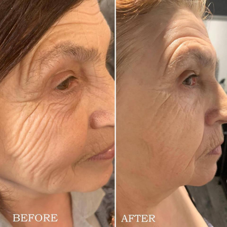 Tratament Anti-Age Soin Multi-Vita Aromalliance BIO [7]