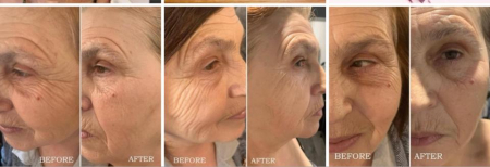 Tratament Anti-Age Soin Multi-Vita Aromalliance BIO [4]