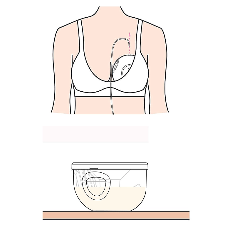 Set Cupe Hands Free 24 mm [6]