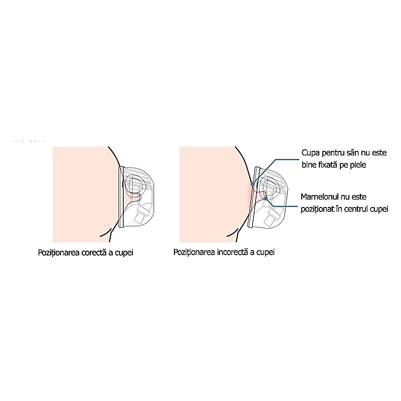 Set Cupe Hands Free 24 mm [5]