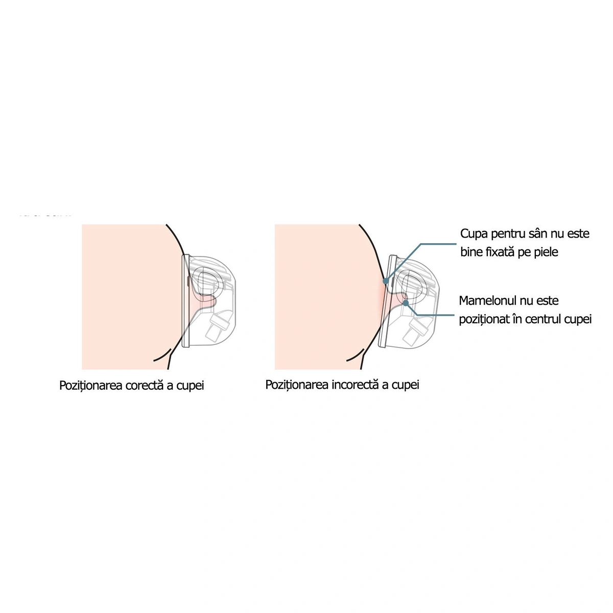 Set Cupe Hands Free (28 mm) [5]