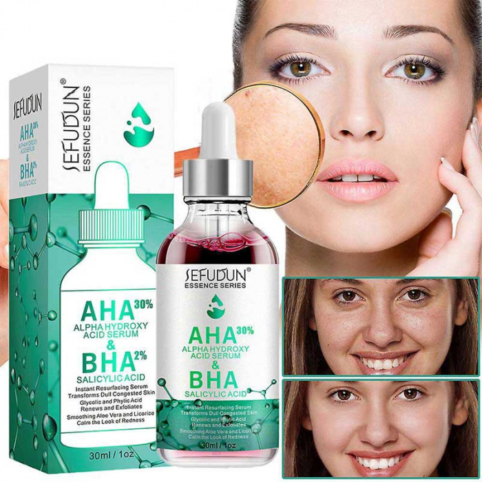 Ser Facial pentru Ten Gras, Efect Anti-Acnee, Anti-Roseata, cu AHA 30% si BHA 2%, SEFUDUN, 30 ml-big