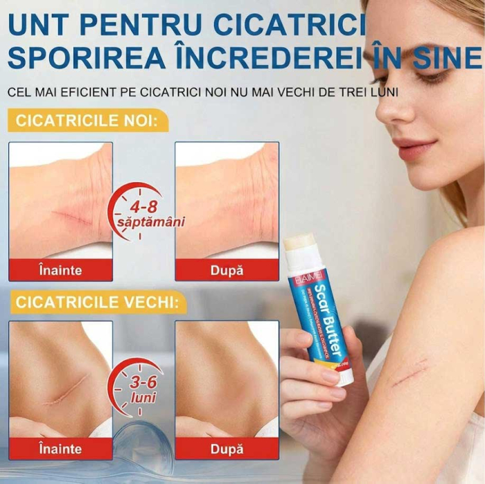 Unt Reparator pentru Cicatrici cu Vitamina E si Cacao, 20 g-big