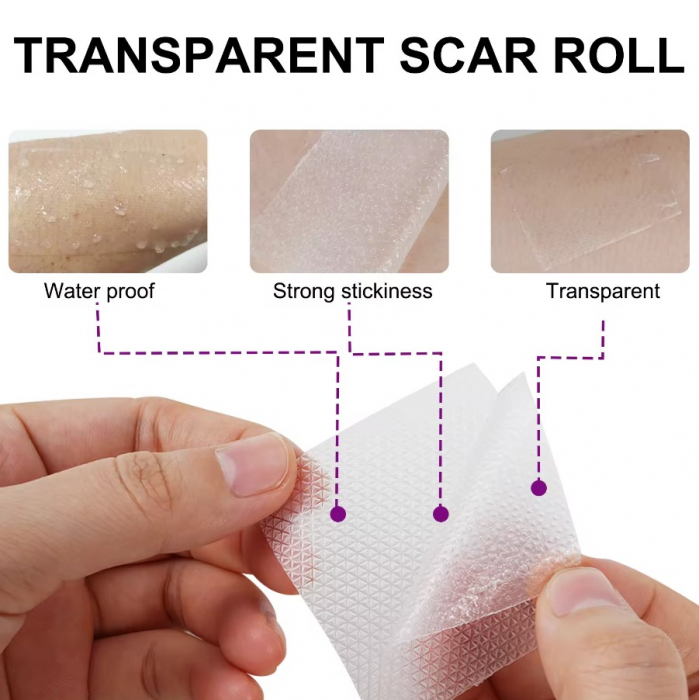 Rola Premium pentru Ascunderea Cicatricilor, Reutilizabila, Transparenta, NOVA KISS®, 4 cm x 3 m-big