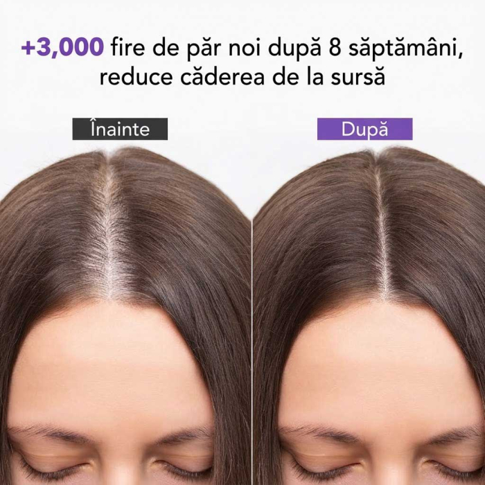 Tratament Impotriva Caderii Parului cu Ginseng, pentru Femei, 13 x 5 ml-big
