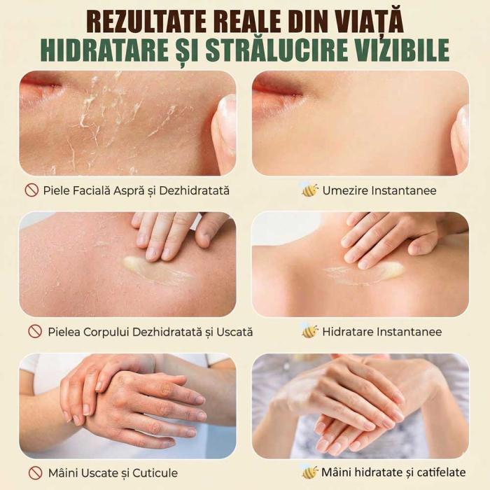 Balsam din Seu de Vita, Miere si Ceara de Albine pentru Hidratare si Reparare, 70 g-big