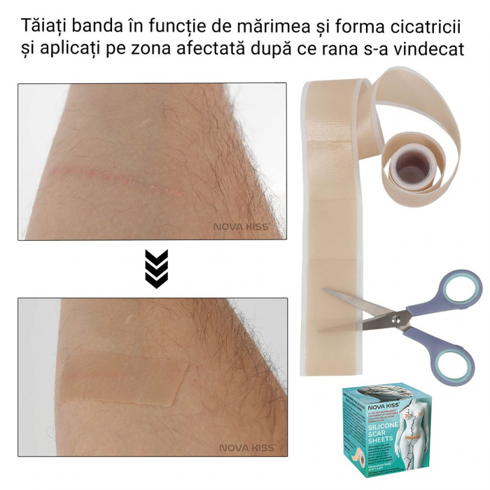 Bandă Premium cu Gel de Silicon Medical pentru Cicatrici, Reutilizabilă, NOVA KISS®-big