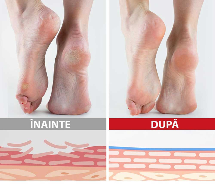 Baton Hidratant pentru Calcaie Crapate si Piele Uscata, 60% Uree, Piersici, 40 g-big