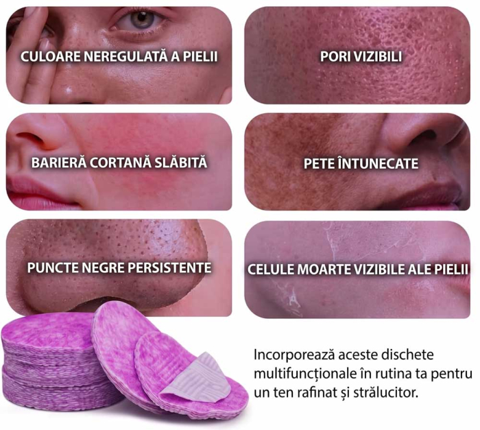 Dischete Tonice Exfoliante si Hidratante cu Extract de Ceapa, 60 buc-big