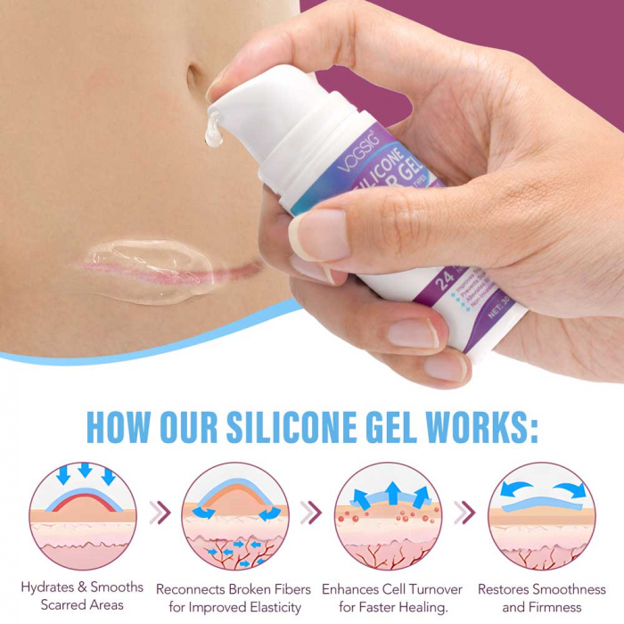 Gel Siliconic pentru Repararea Cicatricilor, Ingrijire intensiva 24 Ore, Formula Avansata Premium, 30 g-big