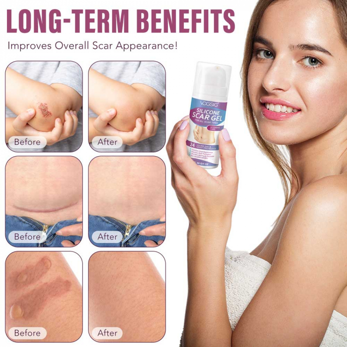 Gel Siliconic pentru Repararea Cicatricilor, Ingrijire intensiva 24 Ore, Formula Avansata Premium, 30 g-big