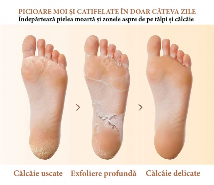 Masca Exfolianta pentru Picioare tip Soseta cu Lavanda, Repara Calcaiele Crapate-big