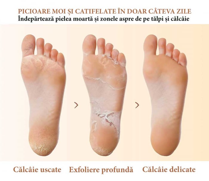 Șosete Exfoliante cu Avocado pentru Picioare, Reparare Profundă și Călcăie Fine-big