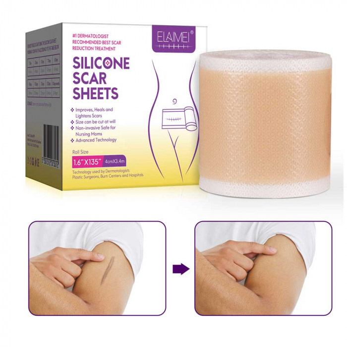 Rola din Silicon Medical pentru Tratarea Cicatricilor, Premium, 4 cm x 3.4 m-big