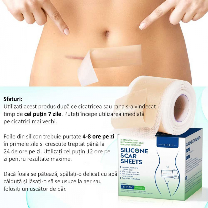 Rola Pansament Premium din Silicon Medical pentru Cicatrici, Reutilizabil, NOVA KISS®, 4 cm x 3.3 m-big