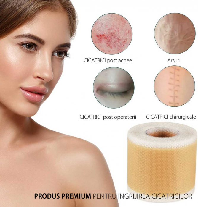 Rola Premium Reutilizabila din Silicon Medical pentru Ascunderea & Ingrijirea Cicatricilor, NOVA KISS®, 4 cm x 1.5 m-big