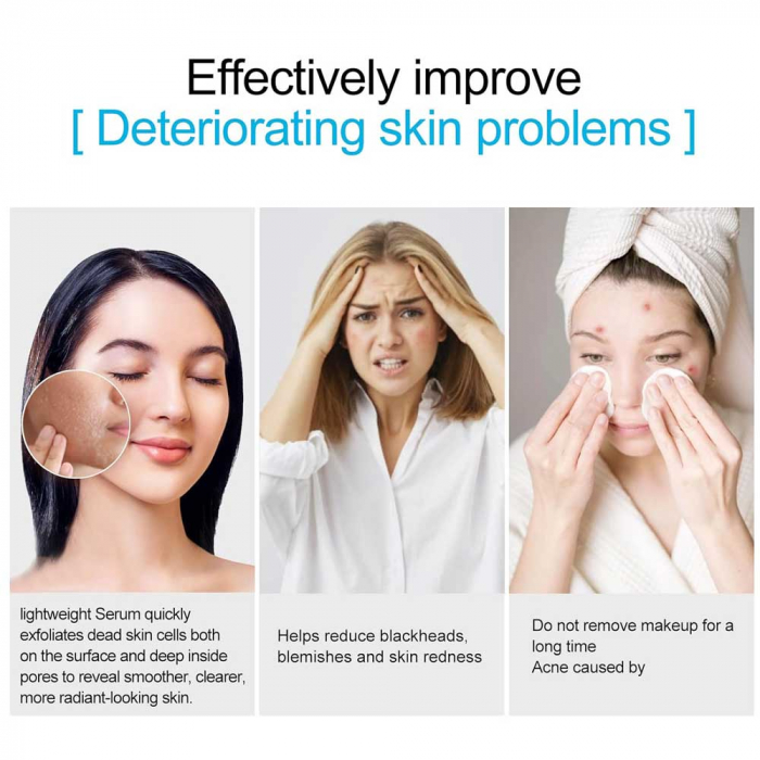 Ser Facial Premium Anti Acnee, Anti pori dilatati si Anti pete pigmentare cu Acid salicilic si 2% BHA, Sefudun, 30 ml-big