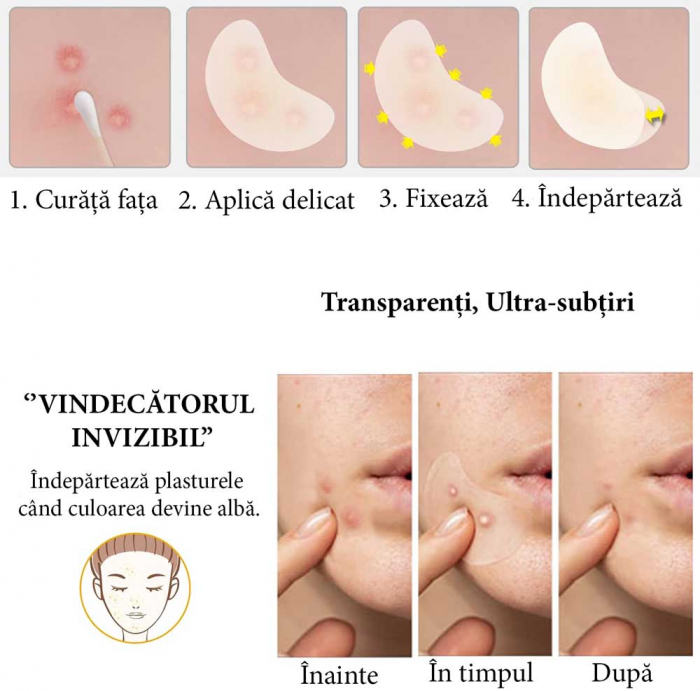 Plasturi Hidrocoloidali Anti-Acnee, Set 20 Bucăți, Transparenți, Ultra-subțiri, Formulă Premium-big