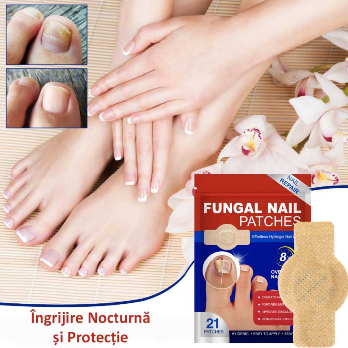 Set 21 Plasturi pentru Unghii Deteriorate si Ingalbenite - Ingrijire Nocturna si Protectie-big