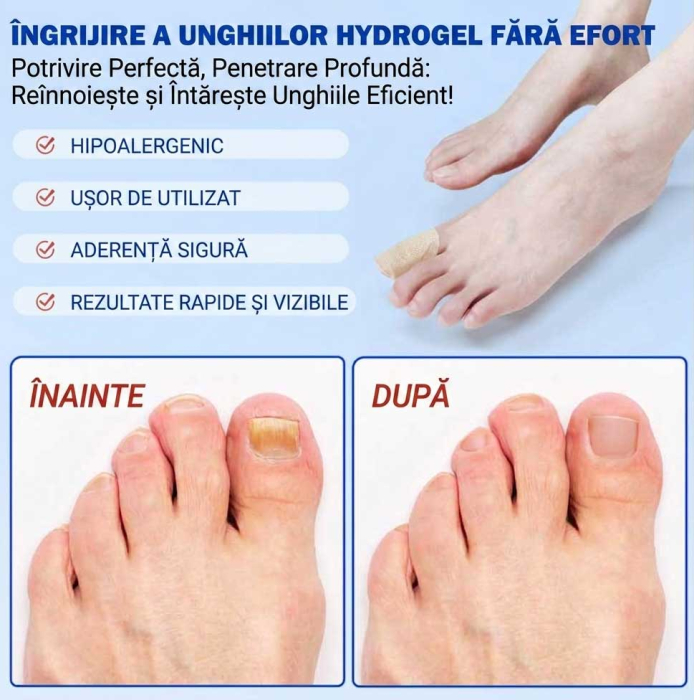 Set 21 Plasturi pentru Unghii Deteriorate si Ingalbenite - Ingrijire Nocturna si Protectie-big