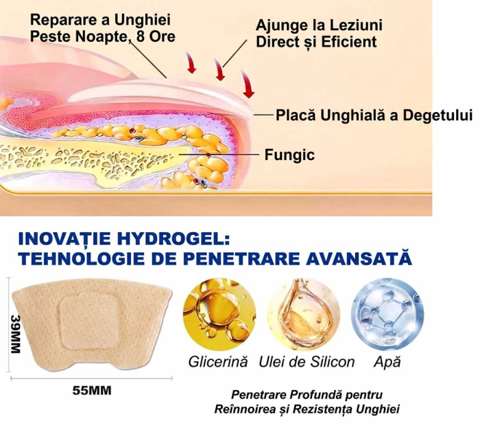 Set 32 Plasturi pentru Unghii Deteriorate si Ingalbenite - Ingrijire Nocturna si Protectie-big