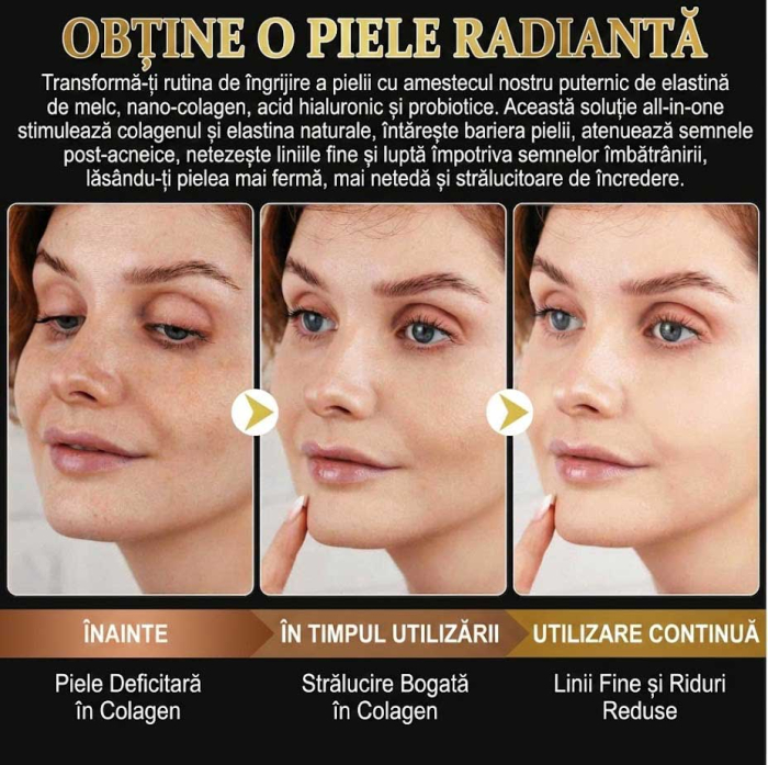 Set 6 Masti de Fata cu Secretie de Melc si Colagen, Efect Anti-Rid, 6 x 34g-big