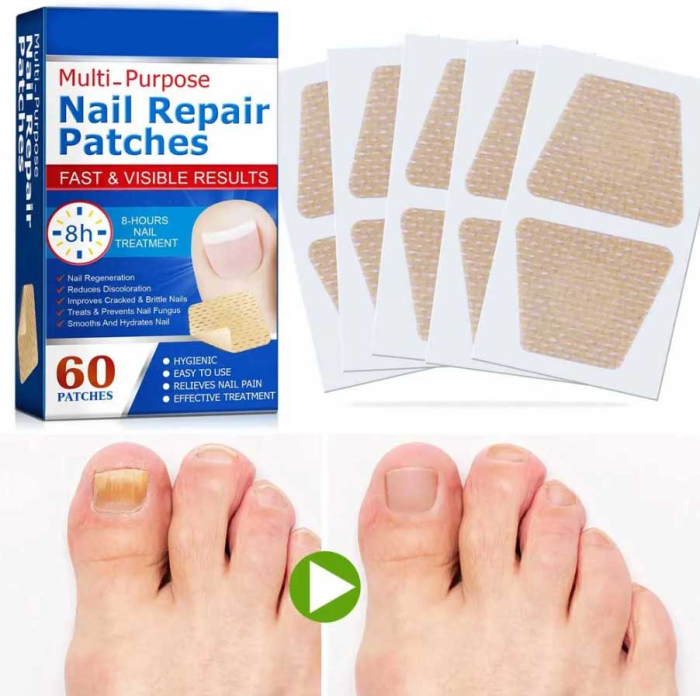 Set 60 Plasturi pentru Unghii Deteriorate, Galbene si Fragile, cu Extract de Arbore de Ceai si Usturoi-big