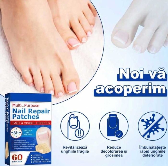 Set 60 Plasturi pentru Unghii Deteriorate, Galbene si Fragile, cu Extract de Arbore de Ceai si Usturoi-big