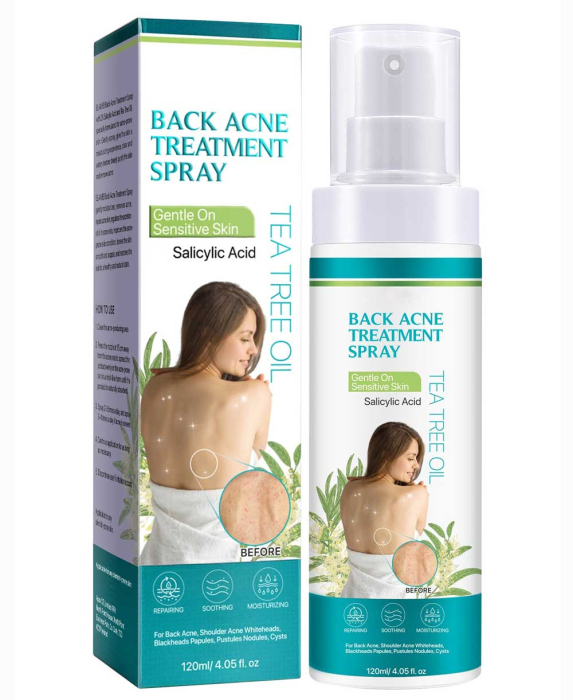Spray Antiacneic pentru Spate si Corp cu Ingrediente Naturale - Reduce Cosurile si Excesul de Sebum, 120 ml-big