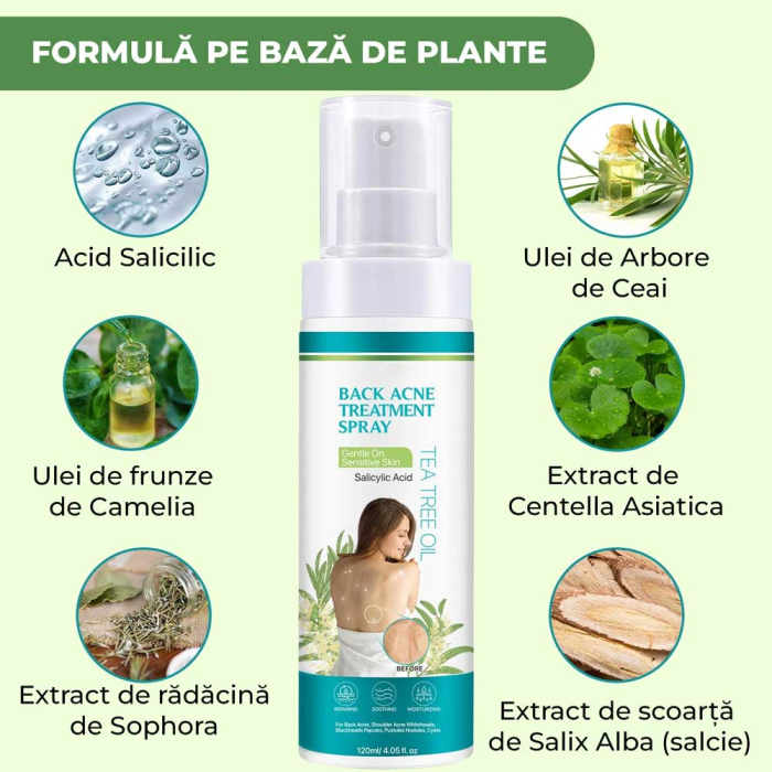 Spray Antiacneic pentru Spate si Corp cu Ingrediente Naturale - Reduce Cosurile si Excesul de Sebum, 120 ml-big