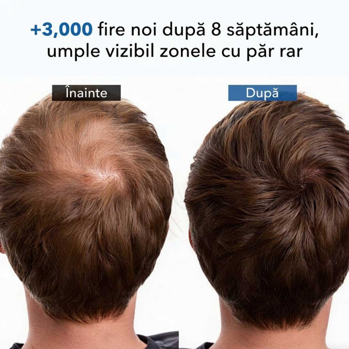 Tratament Impotriva Caderii Parului cu Ginseng, pentru Barbati, 13 x 5 ml-big