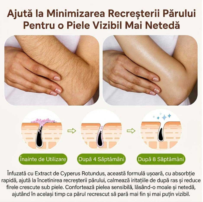 Ulei de Cyperus Rotundus, Roll-On 100% Natural pentru Reducerea Cresterii Parului Nedorit, 60 ml-big