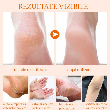 Balsam cu Miere de Manuka pentru Călcâie și Mâini, Reparare Intensivă, 40 g1