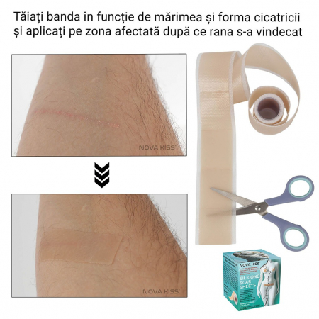 Bandă Premium cu Gel de Silicon Medical pentru Cicatrici, Reutilizabilă, NOVA KISS®9