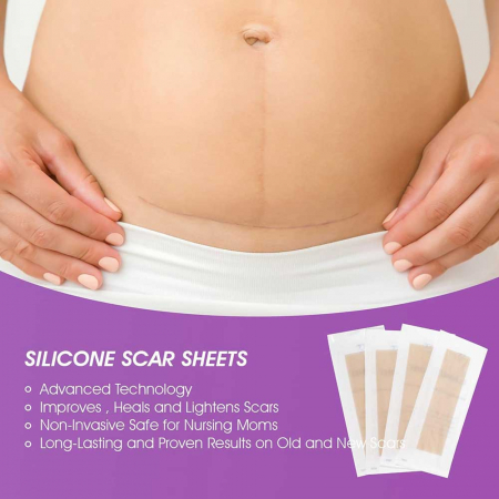 Benzi Premium de Silicon cu Gel pentru Cicatrici, 4 buc, Reutilizabile, 14.98 cm x 4.06 cm1