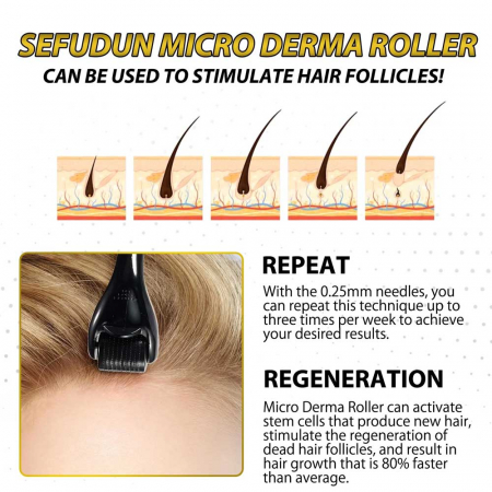 Derma Roller Micro-Needling cu 540 Micro-Ace din Oțel, 0.25 m, Pentru Piele și Scalp3