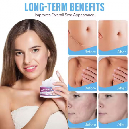 Crema pentru Repararea Cicatricilor si Regenerarea Tesuturilor, 50 g  1