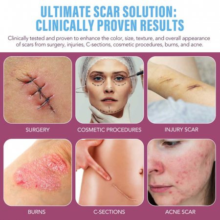 Gel Siliconic pentru Repararea Cicatricilor, Ingrijire intensiva 24 Ore, Formula Avansata Premium, 30 g2