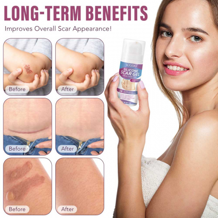 Gel Siliconic pentru Repararea Cicatricilor, Ingrijire intensiva 24 Ore, Formula Avansata Premium, 30 g12