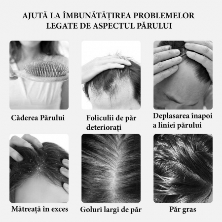 Perie Electrica Premium pentru Stimularea Cresterii Parului, Terapie cu Lumina, Difuzor de Uleiuri Esentiale, Masaj scalp, NOVA KISS®10