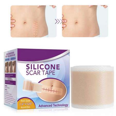 Rola cu Gel de Silicon pentru Cicatrici, Tehnlogie Avansata, 4 cm x 3 m4