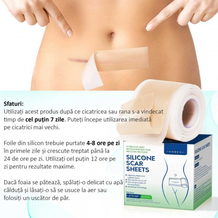 Rola Pansament Premium din Silicon Medical pentru Cicatrici, Reutilizabil, NOVA KISS®, 4 cm x 3.3 m5