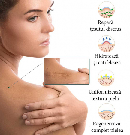 Rola Premium Reutilizabila din Silicon Medical pentru Ascunderea & Ingrijirea Cicatricilor, NOVA KISS®, 4 cm x 1.5 m1