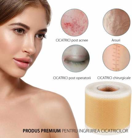 Rola Premium Reutilizabila din Silicon Medical pentru Ascunderea & Ingrijirea Cicatricilor, NOVA KISS®, 4 cm x 1.5 m7