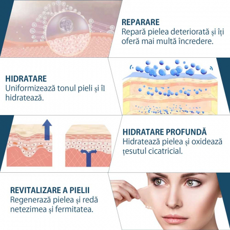 Rola Premium Reutilizabila din Silicon Medical pentru Ascunderea & Ingrijirea Cicatricilor, NOVA KISS®, 4 cm x 1.5 m6
